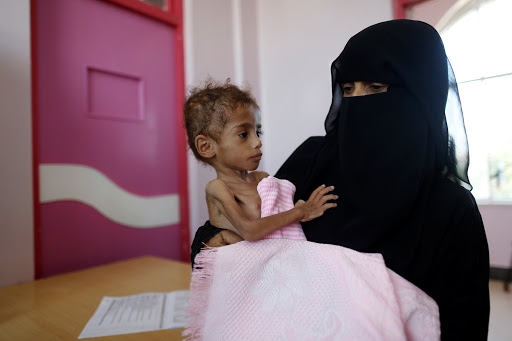 الاطفال المجاعة