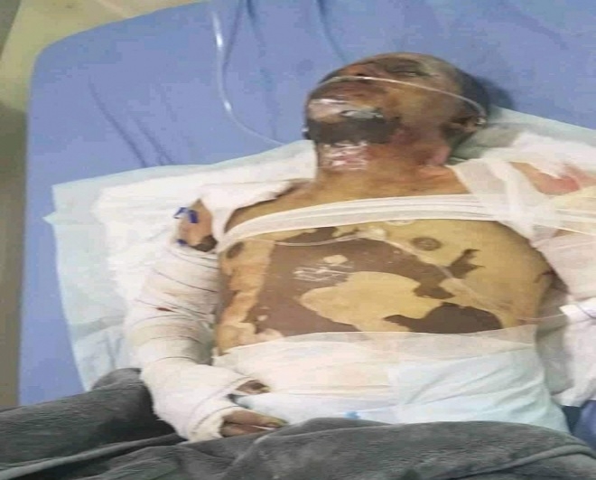 إب.اسطوانة غاز تقود بائع “آيسكريم” الى مصير مؤلم وهذا ما حدث