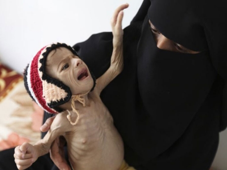 الميثاق نيوز| بابا الفاتيكان يدعو للصلاة لانقاذ اطفال اليمن من