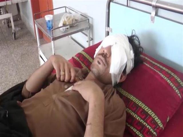 صنعاء ..خمس جرائم وحشية للحوثيين تجاه المعلمين..اقتلعوا عين معلم