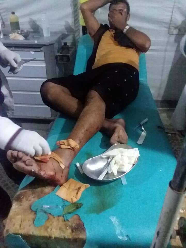 تعز..محاولة اغتيال الجندي عبداالله الشيباني،أثناء اسعافه إلى مست