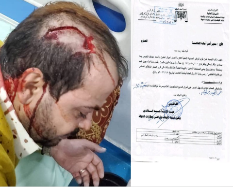 ميليشيا الحوثي تعتدي على التاجر الكبوس في سوق الملح