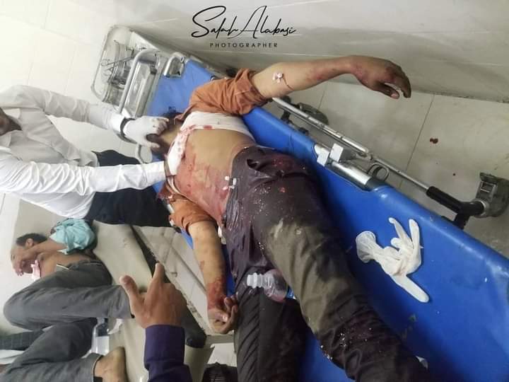خلال أربعة أشهر..إصابة 202 مدنيا بينهم 50 طفلا في تعز (ارشيفية)