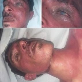 ميليشيا الحوثي تختطف المحويتي وتجبر اسرته على التنازل مقابل الجث