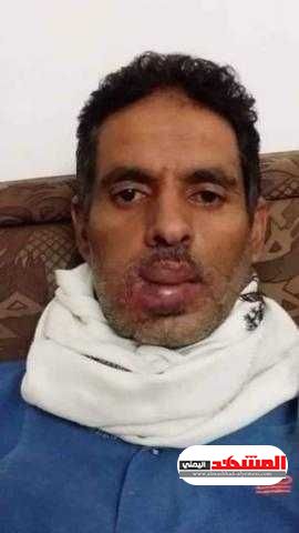 سامي الحيمي