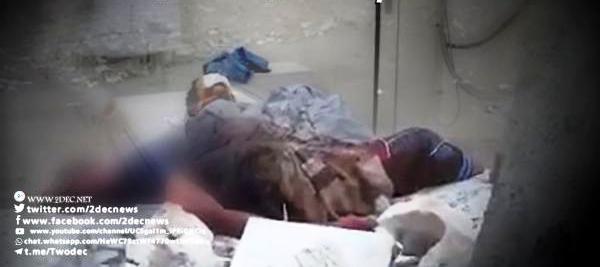 مستشفيات الحوثي تكشف وصول 50 قتيلا وجريحا حوثيا من حيس والدريهمي