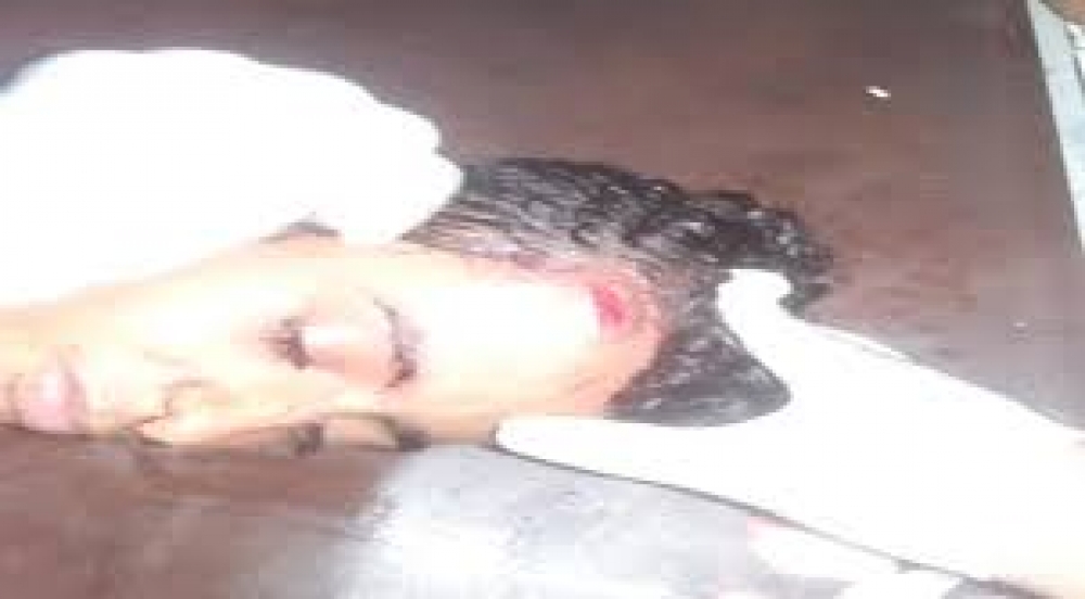 اصابة طفلا في رأسه برصاص قناص حوثي في الحديدة