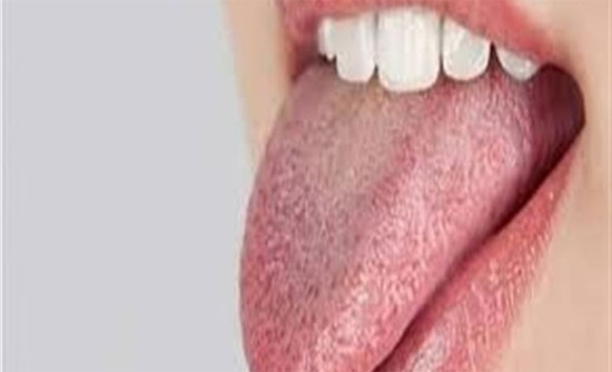 دهون اللسان