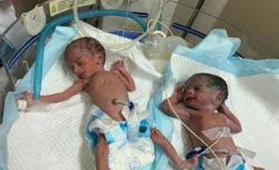 صوره التوأم