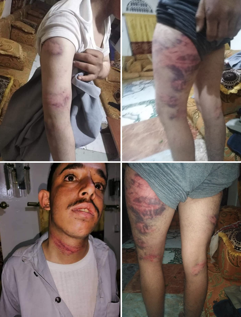تعذيب شاب بطريقة وحشيه من قبل مليشيات الحوثي