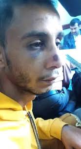 شاب يتعرض لضرب مبرح من مسلحو الحوثي في محافظةإب