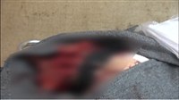 مليشيات الحوثي تفصل رأس مواطن عن جسده بالحديدة