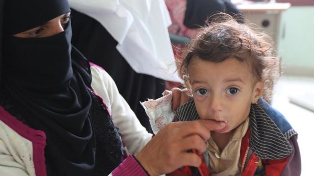 اطفال اليمن في مرمى نيران الحوثي