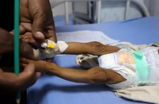 اطفال اليمن والفيروسات المجهولة