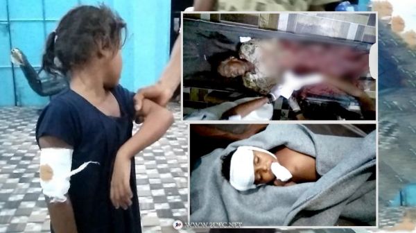 عرس يتحول الى ماتم بقذيفة حوثية في حيس غرب اليمن